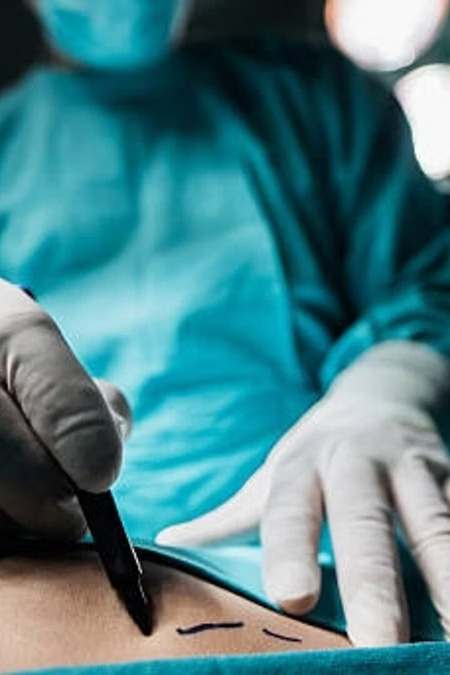 MasterClass Internacional Corporal Abdominoplastia